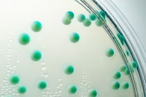 Candida albicans colony in petri dish von Sami Sarkis Photography