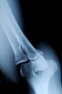 X-ray image of mature's man elbow by Sami Sarkis Photography