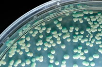 Candida albicans colony in petri dish von Sami Sarkis Photography