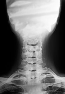 Cervical vertebra and head X-ray by Sami Sarkis Photography