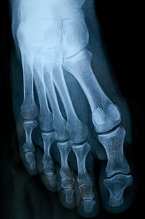 X-ray image of mature man's feet by Sami Sarkis Photography